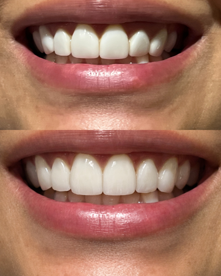 Home diseño sonrisa tefy