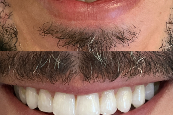 diseño sonrisa mauro