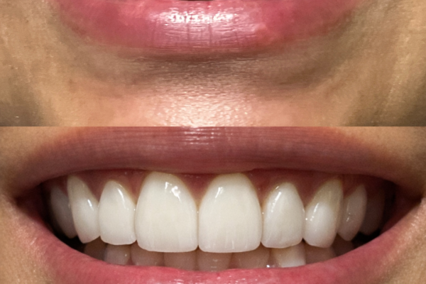 diseño sonrisa tefy